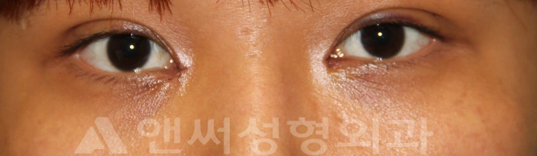 Answer Plastic Surgery case 715: After