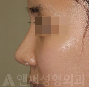 Answer Plastic Surgery case 716: After