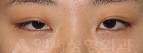Answer Plastic Surgery case 719: Before