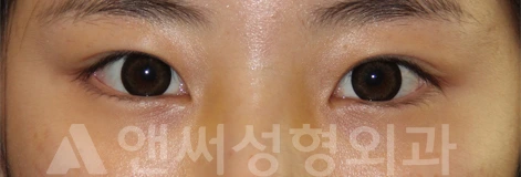 Answer Plastic Surgery case 719: After