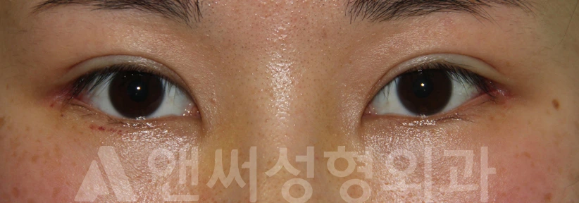 Answer Plastic Surgery case 718: After