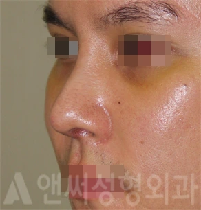 Answer Plastic Surgery case 717: After