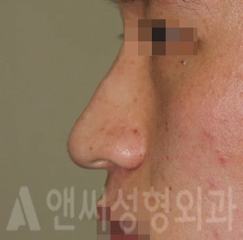 Answer Plastic Surgery case 720: Before