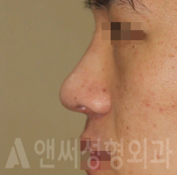Answer Plastic Surgery case 720: After