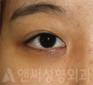 Answer Plastic Surgery case 714: After