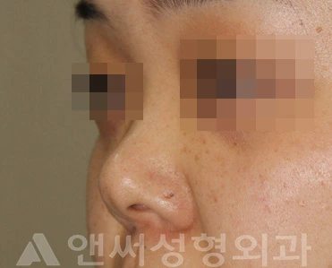 Answer Plastic Surgery case 713: Before