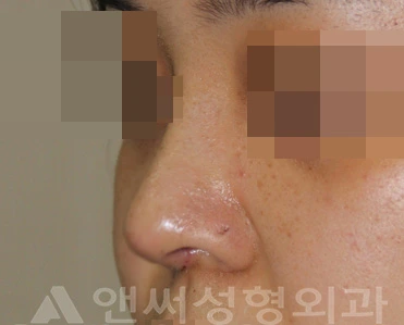 Answer Plastic Surgery case 713: After