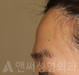 Answer Plastic Surgery case 712: Before