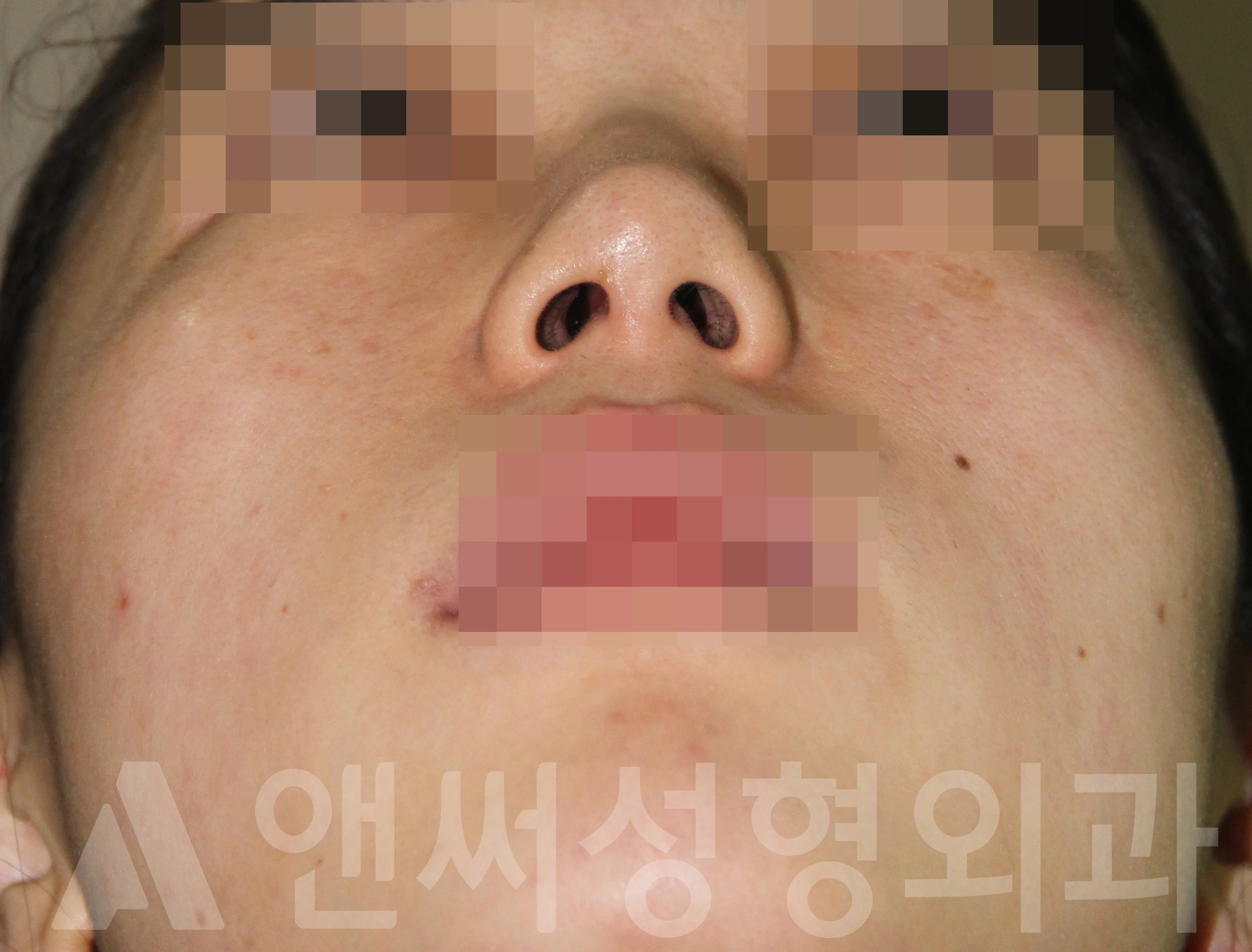 Answer Plastic Surgery case 711: Before