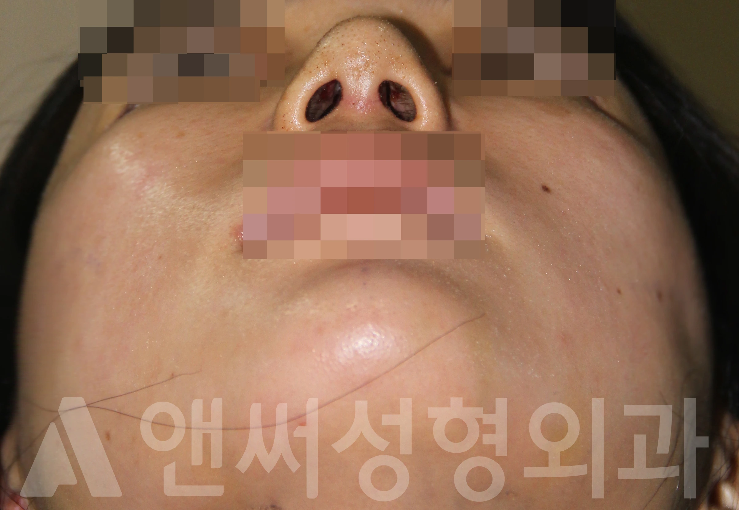 Answer Plastic Surgery case 711: After