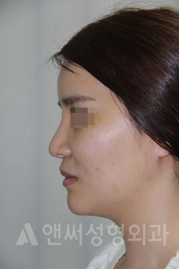 Answer Plastic Surgery case 706: After