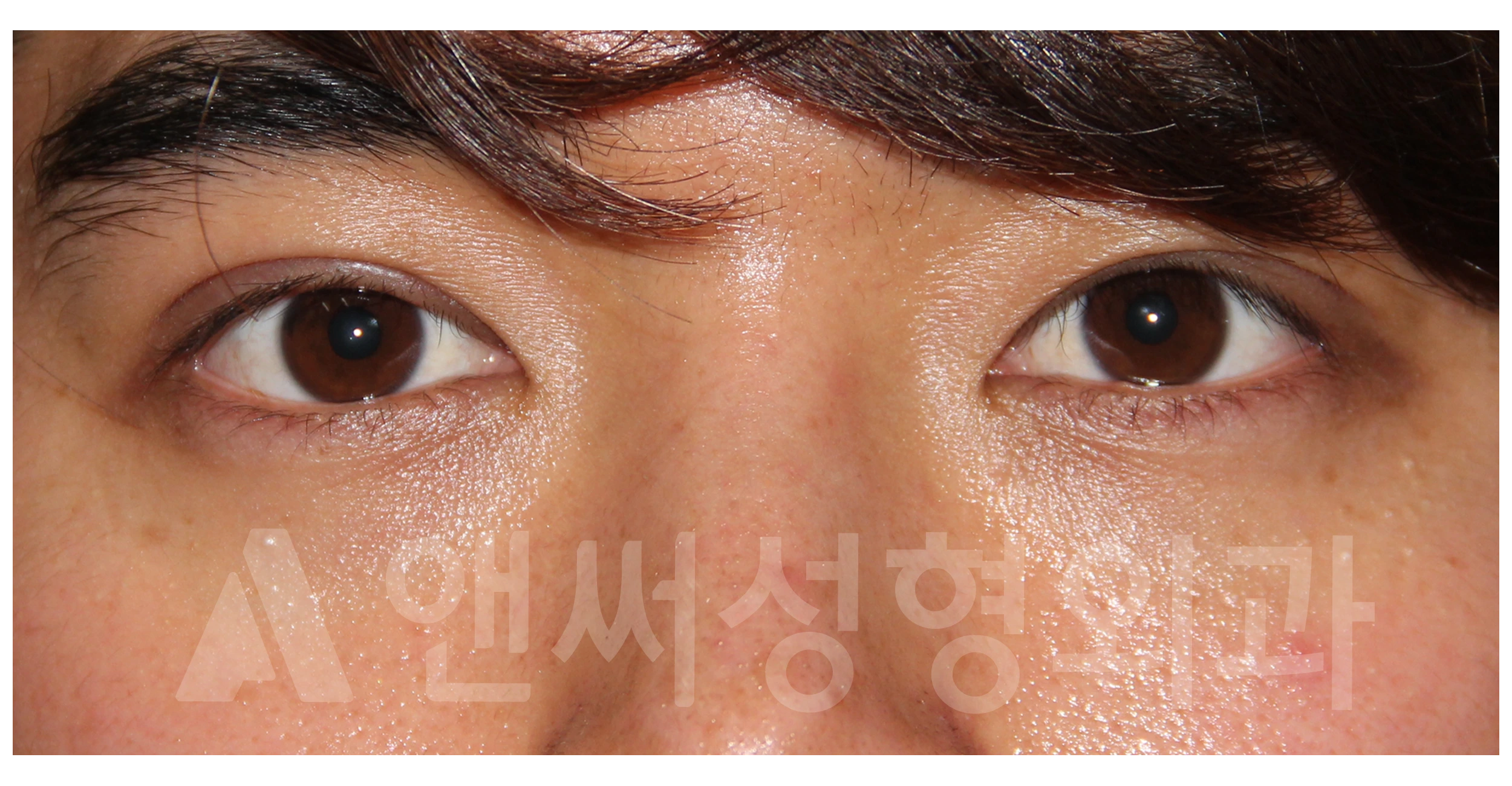 Answer Plastic Surgery case 705: After