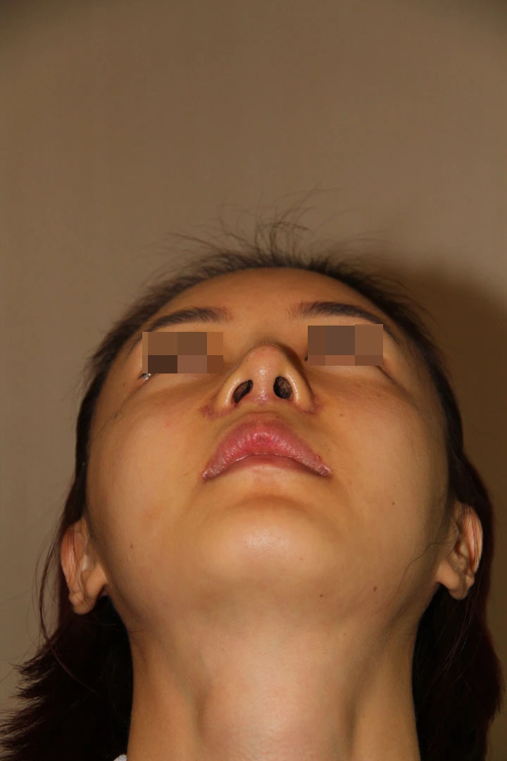 Answer Plastic Surgery case 704: Before
