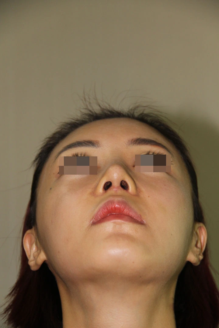 Answer Plastic Surgery case 704: After