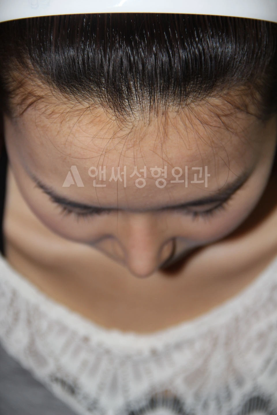 Answer Plastic Surgery case 703: After