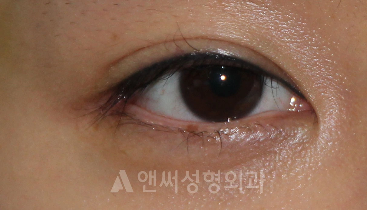 Answer Plastic Surgery case 702: After