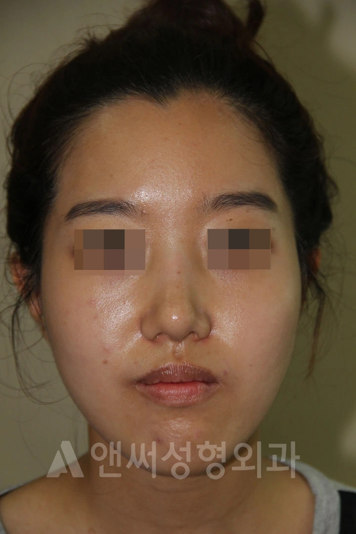 Answer Plastic Surgery case 701: After