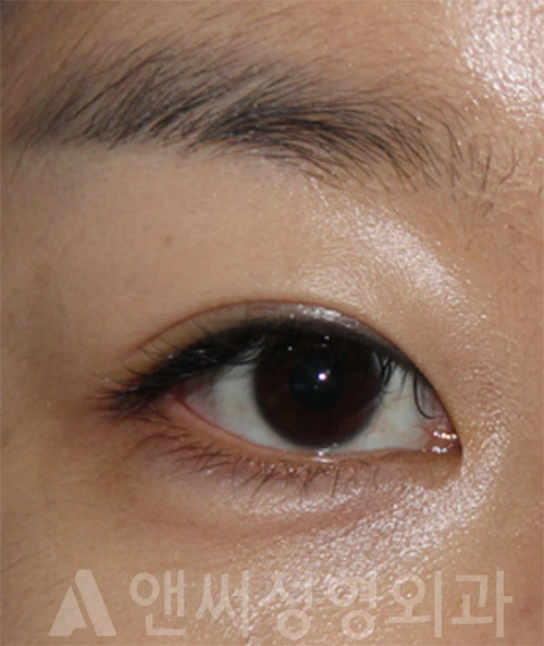 Answer Plastic Surgery case 700: After