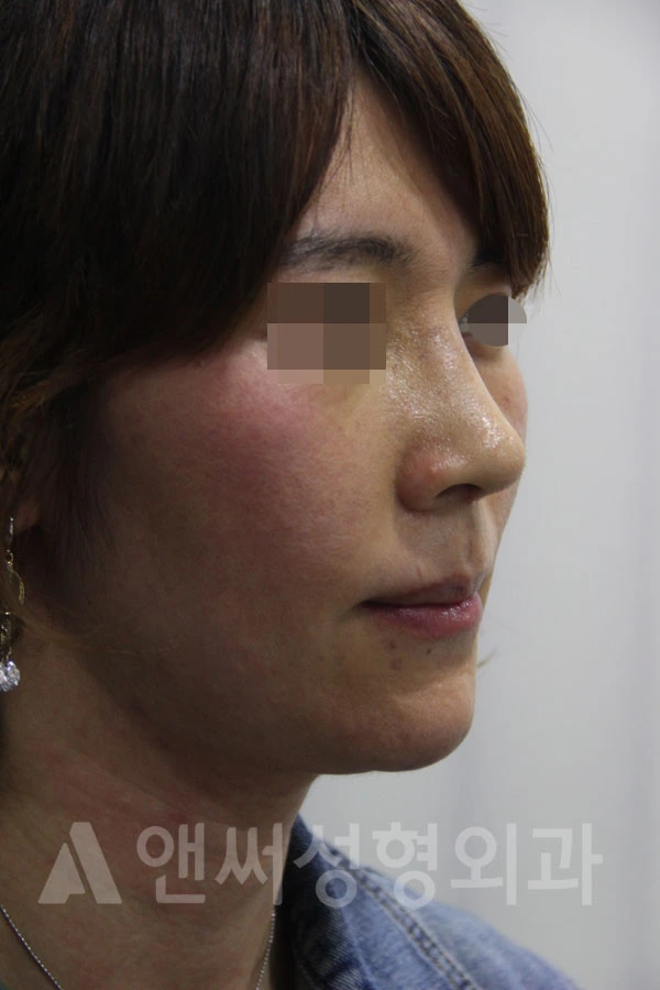 Answer Plastic Surgery case 710: After