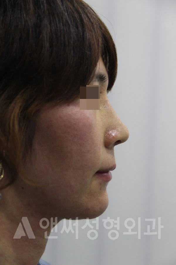 Answer Plastic Surgery case 709: After