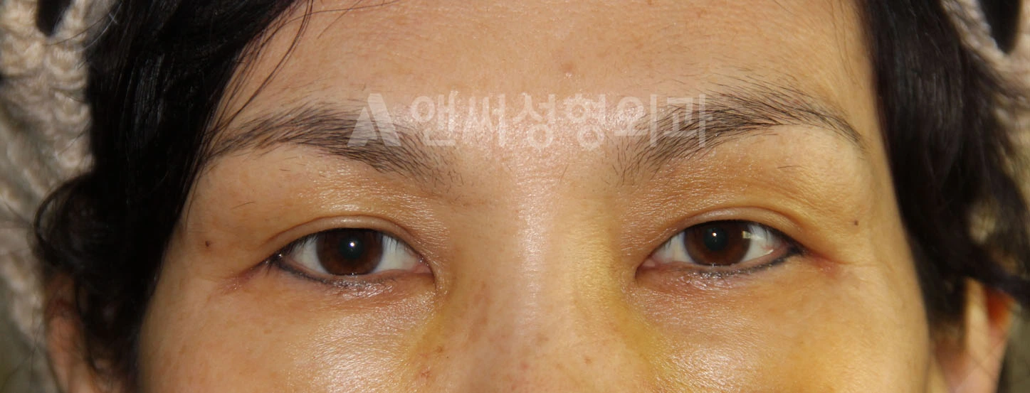 Answer Plastic Surgery case 707: After