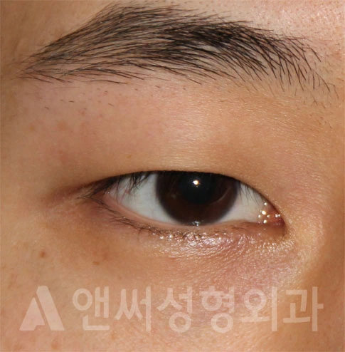 Answer Plastic Surgery case 699: Before
