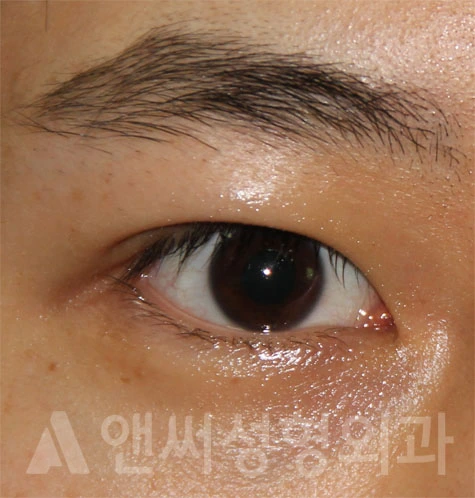 Answer Plastic Surgery case 699: After