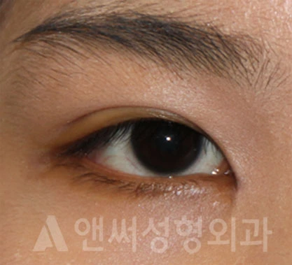 Answer Plastic Surgery case 698: After