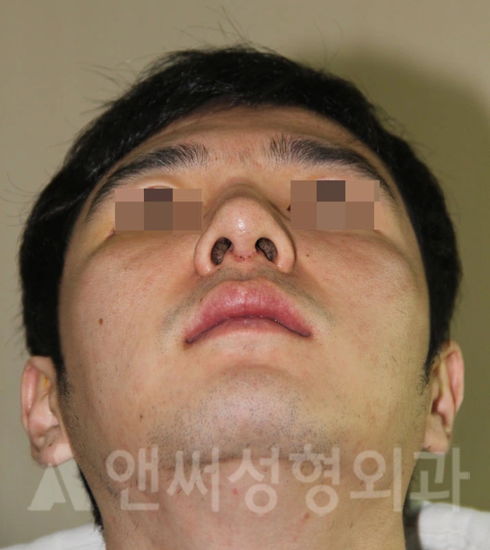Answer Plastic Surgery case 697: After