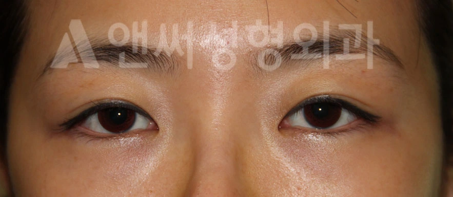 Answer Plastic Surgery case 696: Before