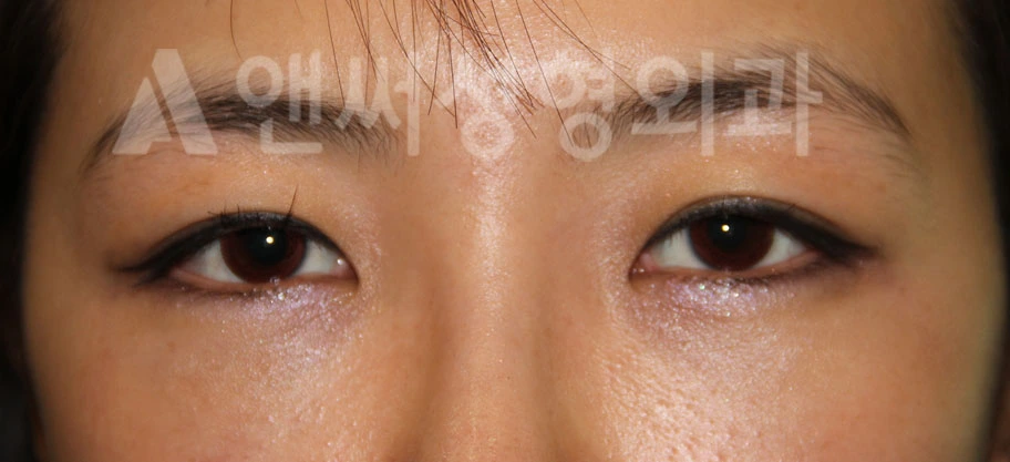 Answer Plastic Surgery case 696: After