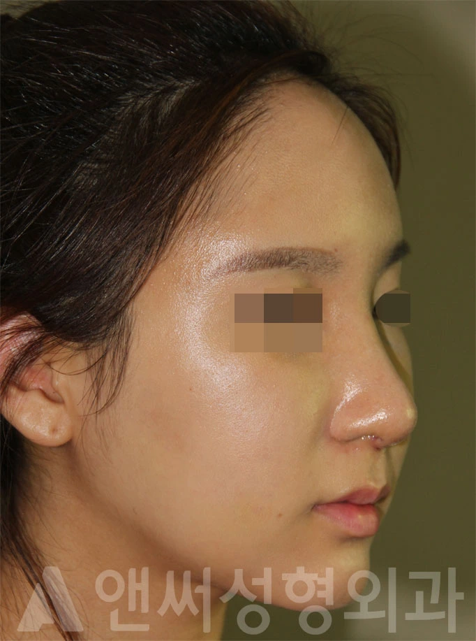 Answer Plastic Surgery case 695: After