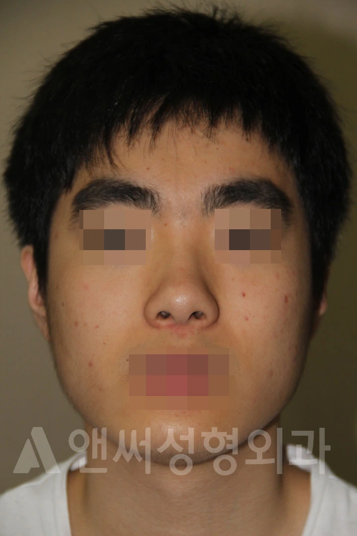 Answer Plastic Surgery case 694: Before