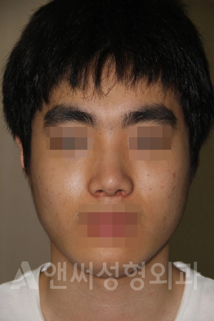 Answer Plastic Surgery case 694: After
