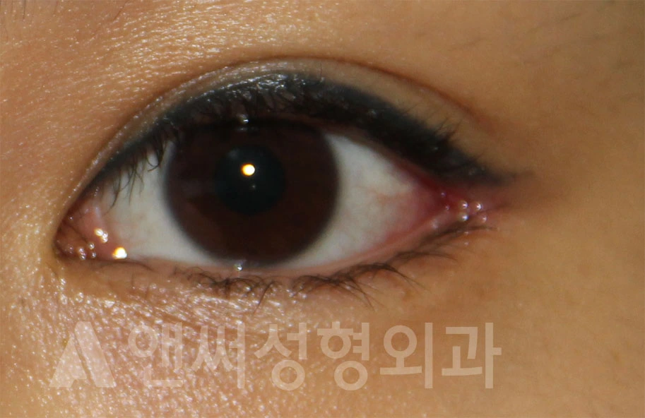Answer Plastic Surgery case 693: After