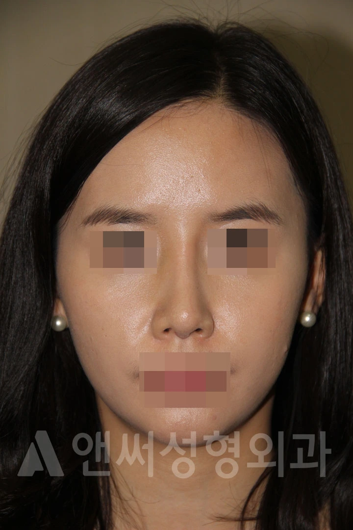Answer Plastic Surgery case 691: After