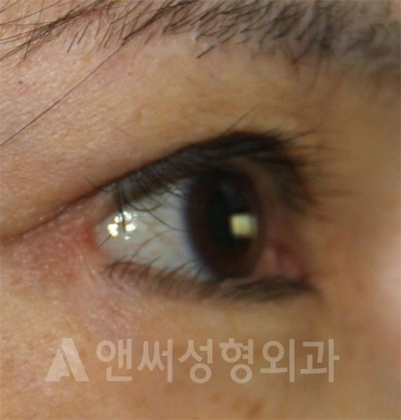 Answer Plastic Surgery case 690: Before