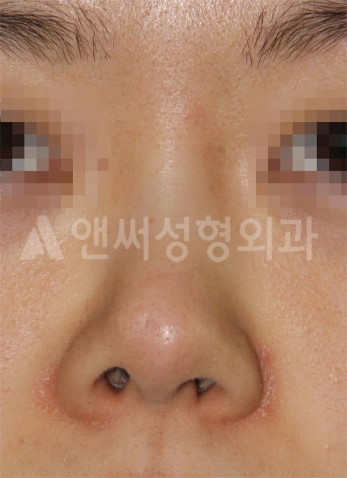 Answer Plastic Surgery case 689: Before