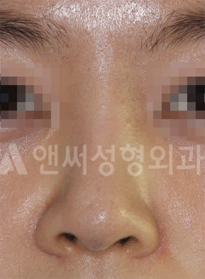 Answer Plastic Surgery case 689: After