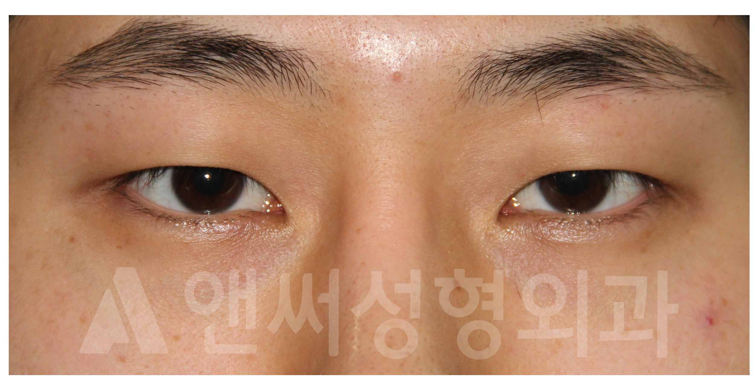 Answer Plastic Surgery case 688: Before