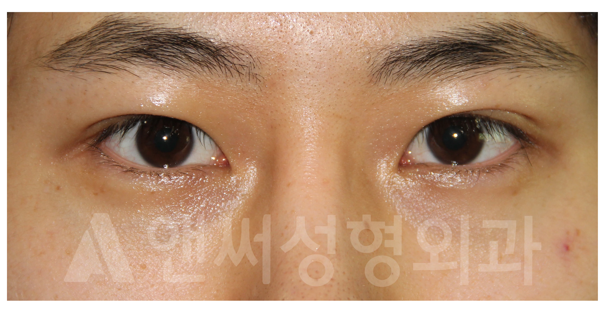Answer Plastic Surgery case 688: After