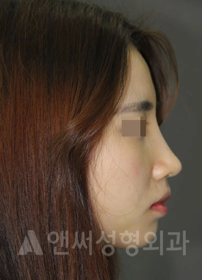 Answer Plastic Surgery case 687: After
