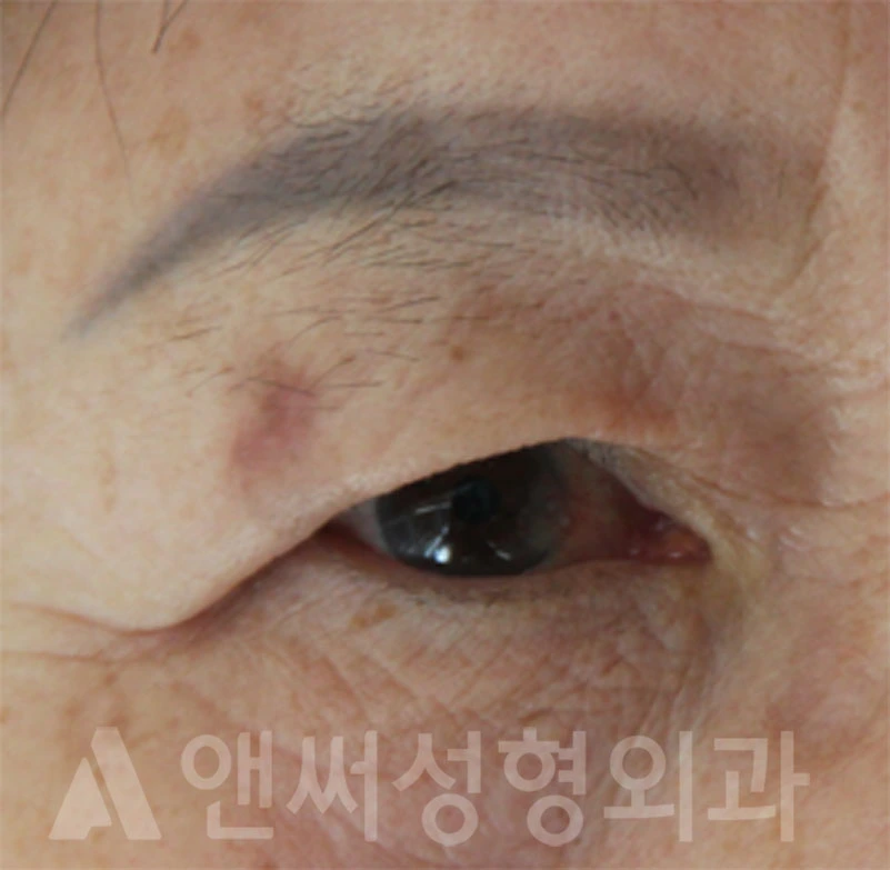 Answer Plastic Surgery case 686: Before