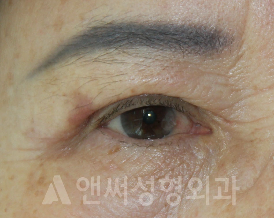 Answer Plastic Surgery case 686: After