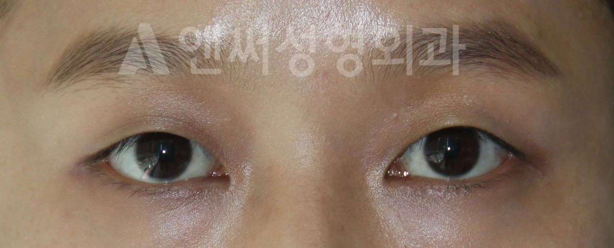 Answer Plastic Surgery case 685: Before