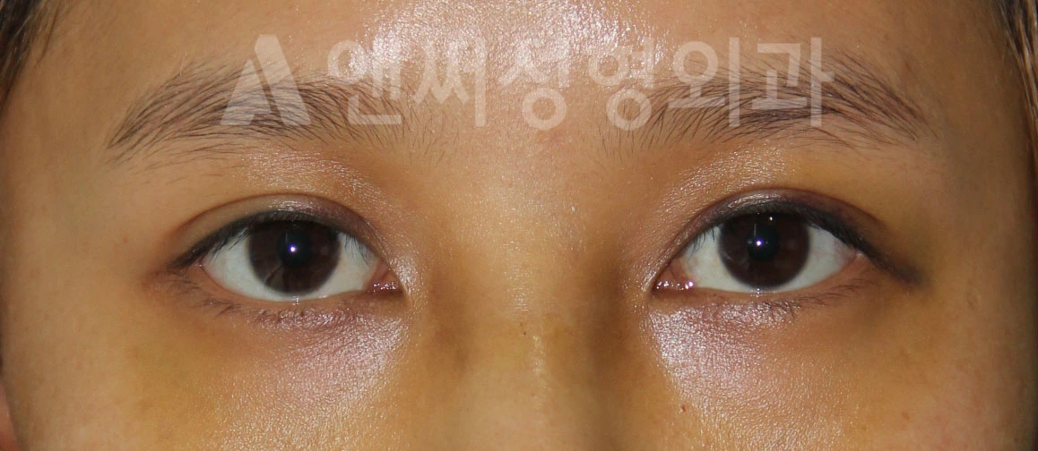 Answer Plastic Surgery case 685: After