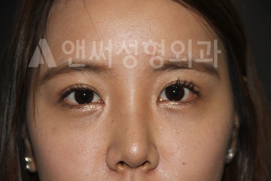 Answer Plastic Surgery case 684: After
