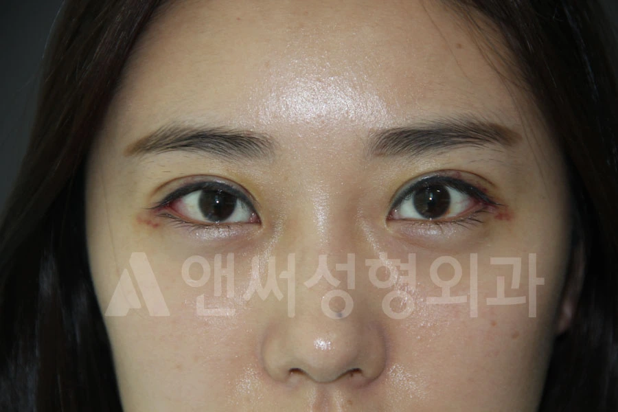 Answer Plastic Surgery case 683: After