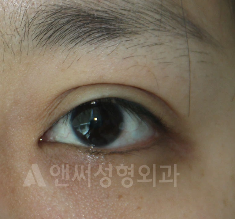 Answer Plastic Surgery case 682: Before
