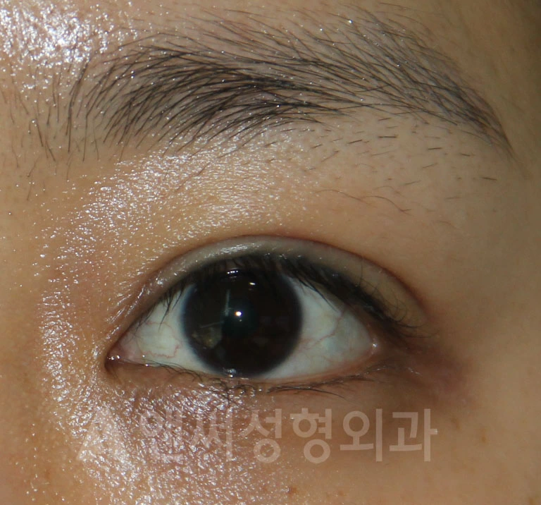Answer Plastic Surgery case 682: After